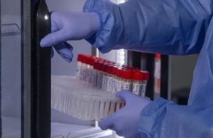 Viruela del mono: OMS confirma más de cinco mil casos en el mundo