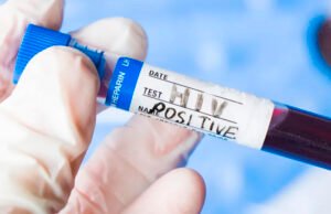 Anuncian acuerdo para acceso al primer fármaco inyectable para prevenir VIH