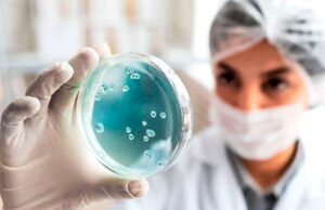 Edomex reporta primeros dos casos de viruela del mono