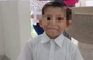 Niño de Mérida se debate entre la vida y la muerte por picadura de garrapata