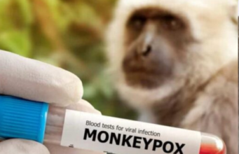 México suma 386 casos de viruela del mono, se distribuyen en 24 entidades