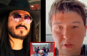 Fofo Márquez aparece golpeado por el Rey Grupero; filtran video de la agresión