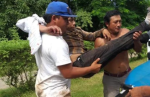 Tizimileño sufre picadura de víbora venenosa