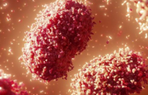 Yucatán suma 77 caso de viruela del mono