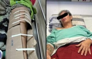 LE COLOCAN UN CARTÓN PARA INMOVILIZAR SU FRACTURA EN EL IMSS EN YUCATÁN