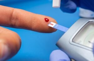 “Estadísticas Preocupantes: La Diabetes Mellitus Tipo II Entre las Principales Causas de Mortalidad en Yucatán”