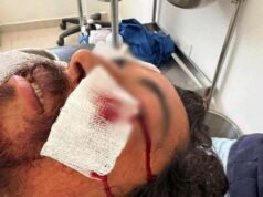 Investigan incidente en Sisal que dejó a pescador hospitalizado; señalan presunta participación de funcionario municipal