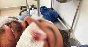 Investigan incidente en Sisal que dejó a pescador hospitalizado; señalan presunta participación de funcionario municipal