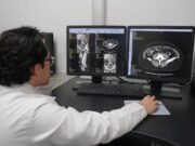 IMSS Yucatán moderniza su atención con tomógrafos de última generación para diagnósticos más rápidos y precisos