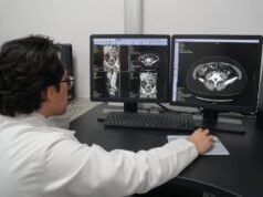 IMSS Yucatán moderniza su atención con tomógrafos de última generación para diagnósticos más rápidos y precisos