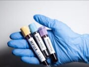 Yucatán confirma nuevos casos de Mpox y se mantiene como la segunda entidad con mayor incidencia en el país