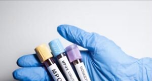 Yucatán confirma nuevos casos de Mpox y se mantiene como la segunda entidad con mayor incidencia en el país
