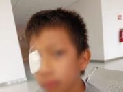Madre denuncia presunta falta de mantenimiento tras accidente que dejó lesionado a un menor en parque de Maxcanú