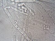Salud confirma 33 casos de ciclosporiasis en México; descartan evidencia de que el brote en EE.UU. se originara en el país