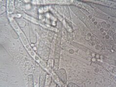 Salud confirma 33 casos de ciclosporiasis en México; descartan evidencia de que el brote en EE.UU. se originara en el país